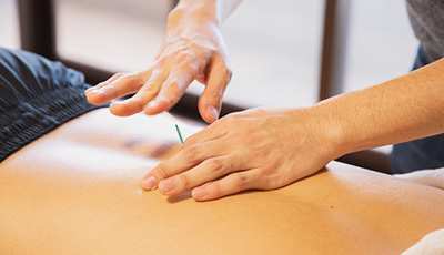 Best Physiotherapy in Brampton